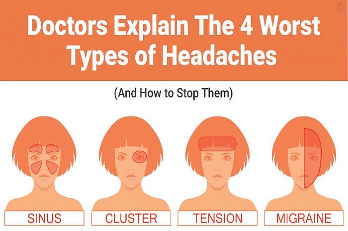 All Types of Headaches
