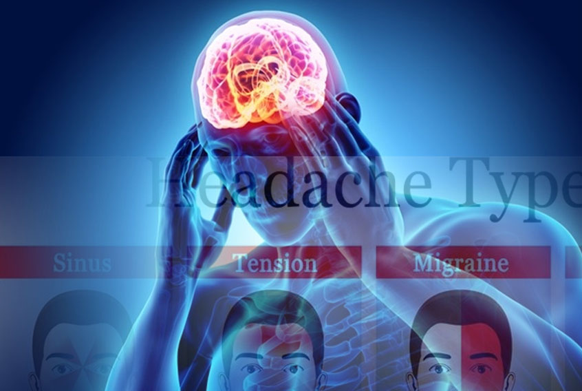 Migraine and Depression May Share Genetic Component