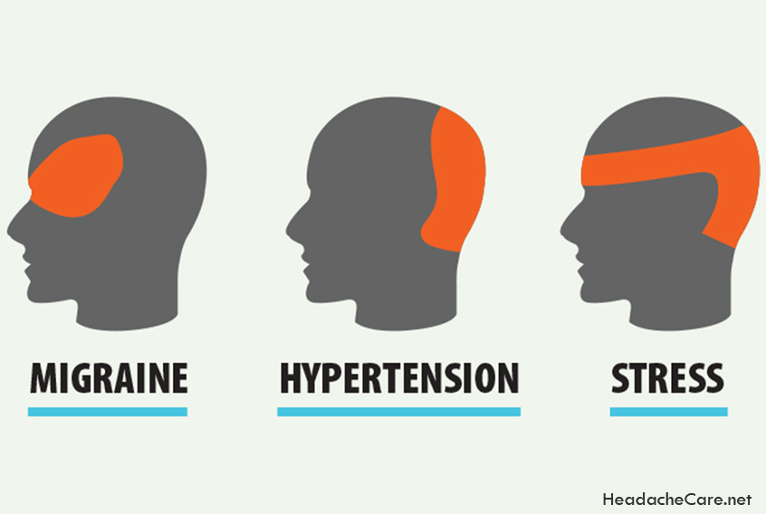 Classification Of Headaches
