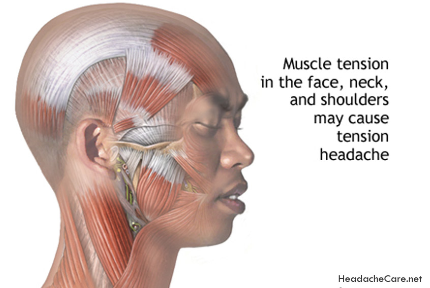 Болит голова и мышцы шеи. Напряженные мышцы головы. Перикраниальные мышцы затылка. Перенапряжение мышц шеи и головы.