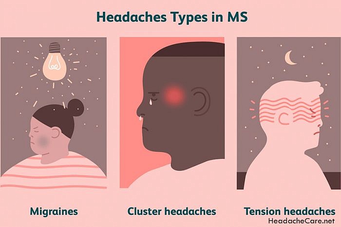 Can A Chiropractor Help With Headaches?