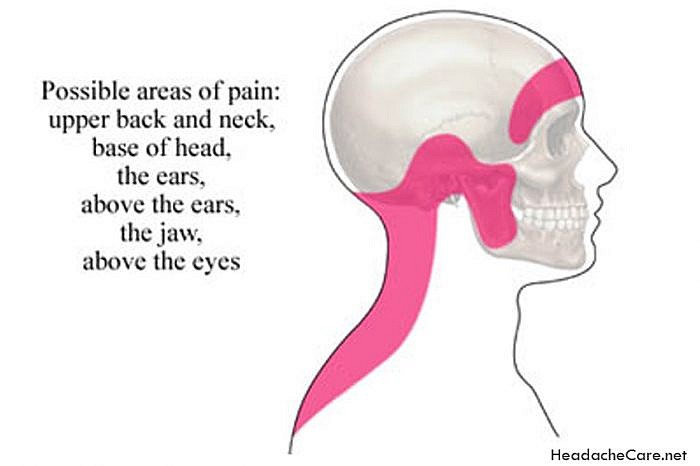 Tips On How To Handle and Treat Sinus Headache Symptoms