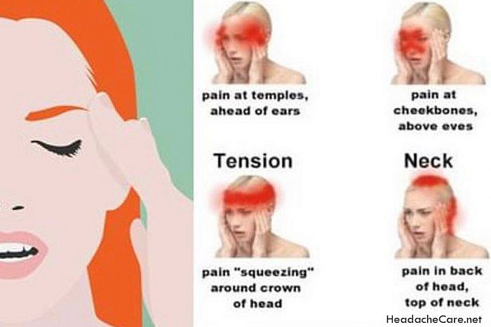 What Are The Symptoms Of A Migraine Headache?