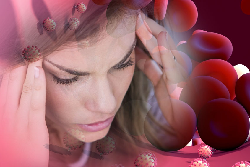 Post–COVID-19 Headache and Migraine